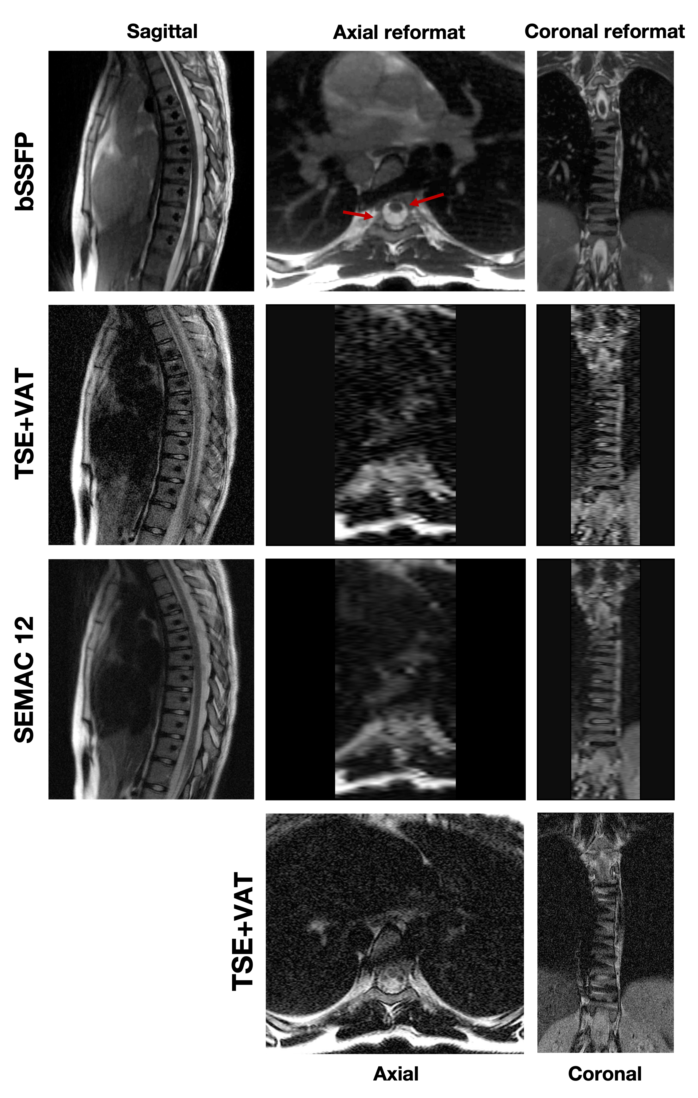 Project Details - MRI 1