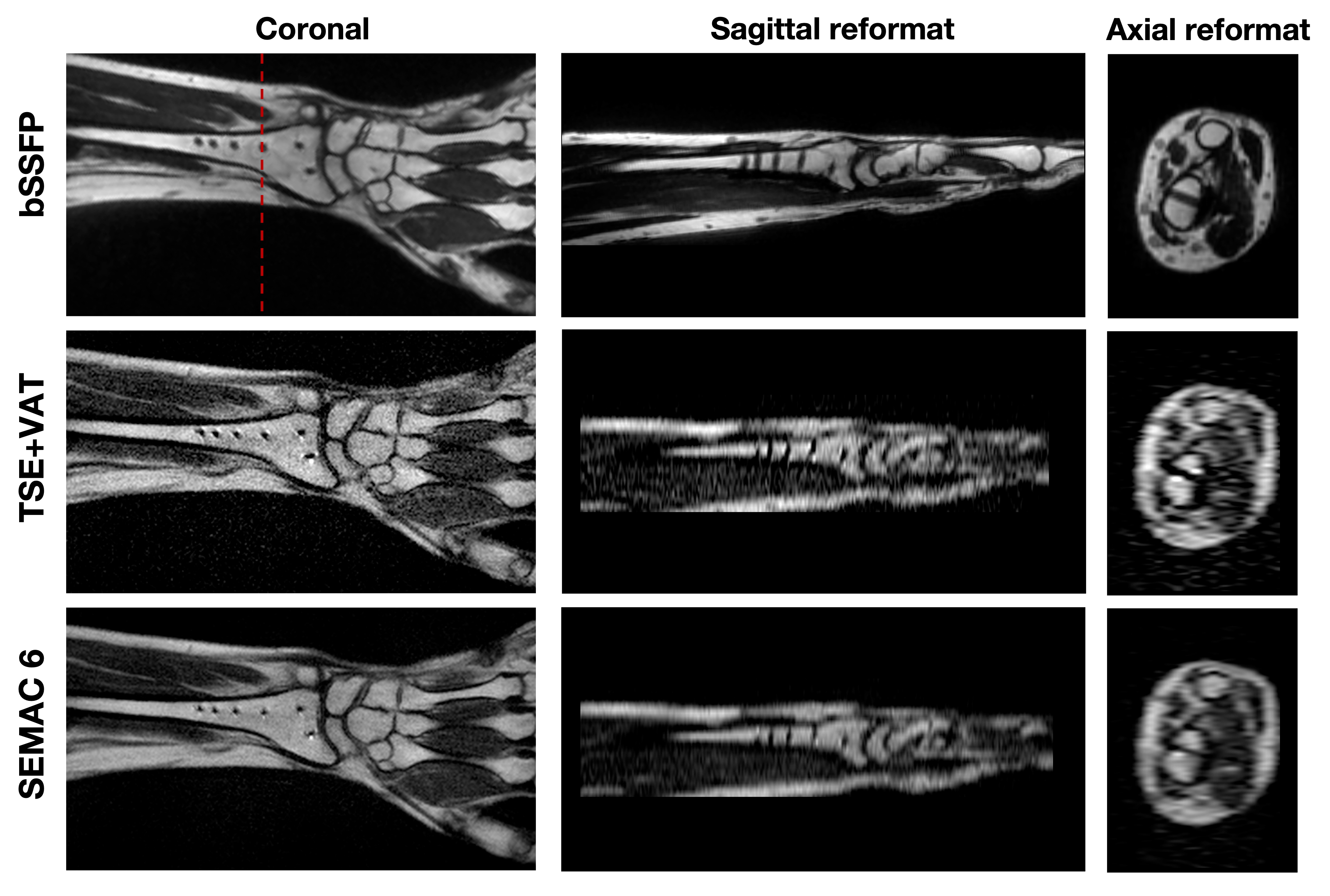 Project Details - MRI 1
